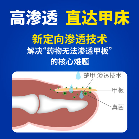 盐酸阿莫罗芬搽剂(楚甲)包装侧面图3 盐酸阿莫罗芬搽剂(楚甲)包装侧面图3