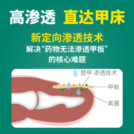 盐酸阿莫罗芬搽剂(楚甲)包装侧面图3 盐酸阿莫罗芬搽剂(楚甲)包装侧面图3