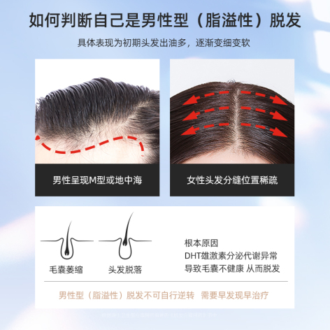 米诺地尔酊(蔓迪)包装侧面图4 米诺地尔酊(蔓迪)包装侧面图4